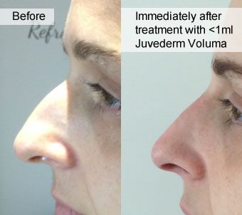 Before and after